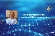 Májrákot (hepatocelluláris carcinoma, HCC) diagnosztizáltak
